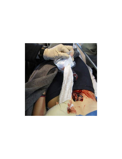 „EZ-Gauze“ Tvarstis tamponavimui be hemostatinės medžiagos